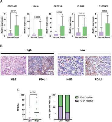 Pan-cancer analysis identifies proteasome 26S subunit, ATPase (PSMC) family genes, and related signatures associated with prognosis, immune profile, and therapeutic response in lung adenocarcinoma